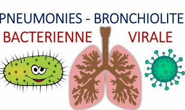 Bronchite vs Pneumonie : comment faire la différence ?